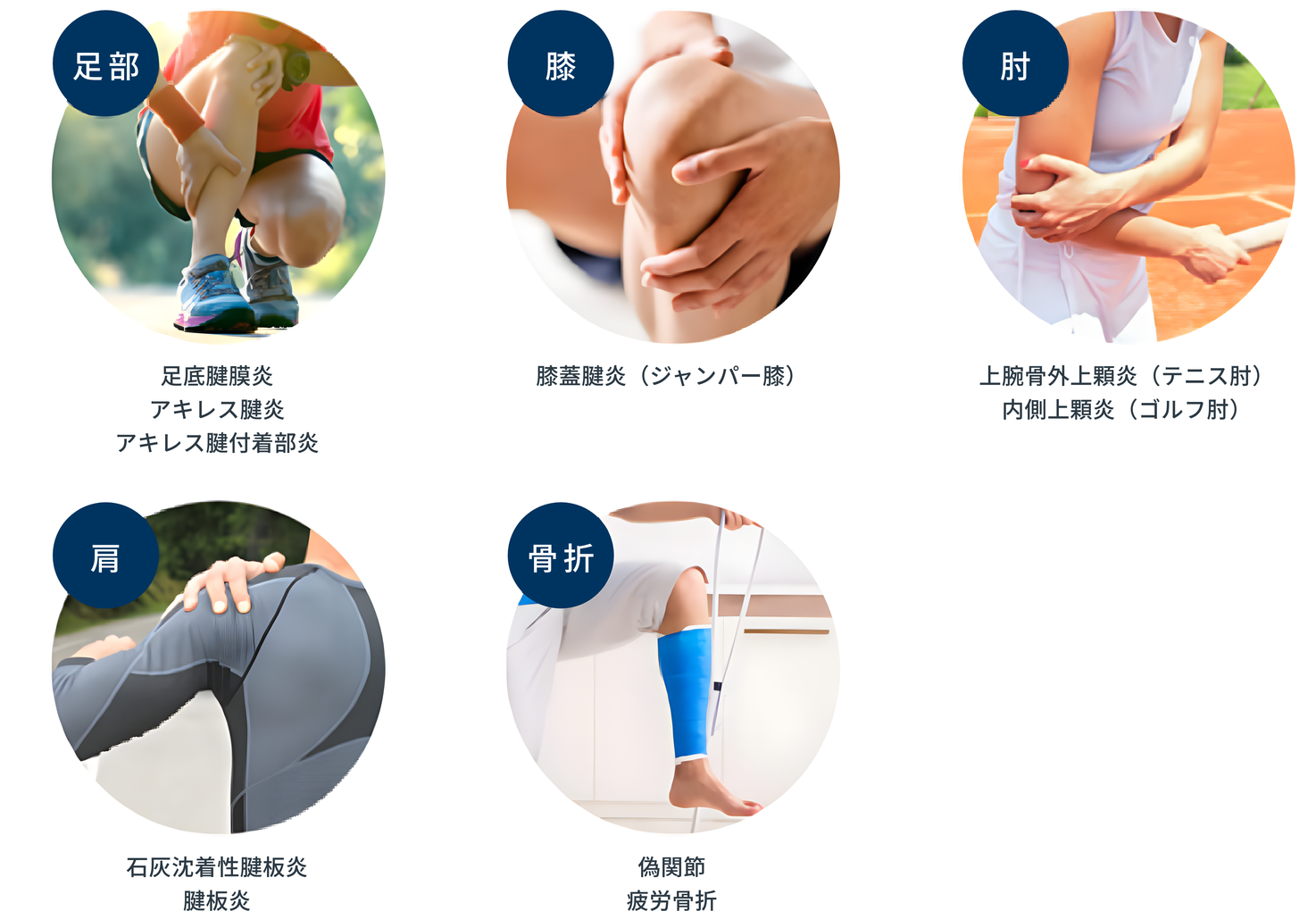 体外衝撃波治療の対象となる疾患：足部（足底腱膜炎／アキレス腱炎／アキレス腱付着部炎）、膝（膝蓋腱炎・ジャンパー膝）、肘（上腕骨外上顆炎・テニス肘／内側上顆炎・ゴルフ肘）、肩（石灰沈着性腱板炎／腱板炎）、骨折（偽関節／疲労骨折）