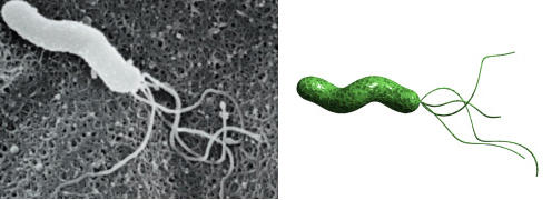ピロリ菌イメージ画像