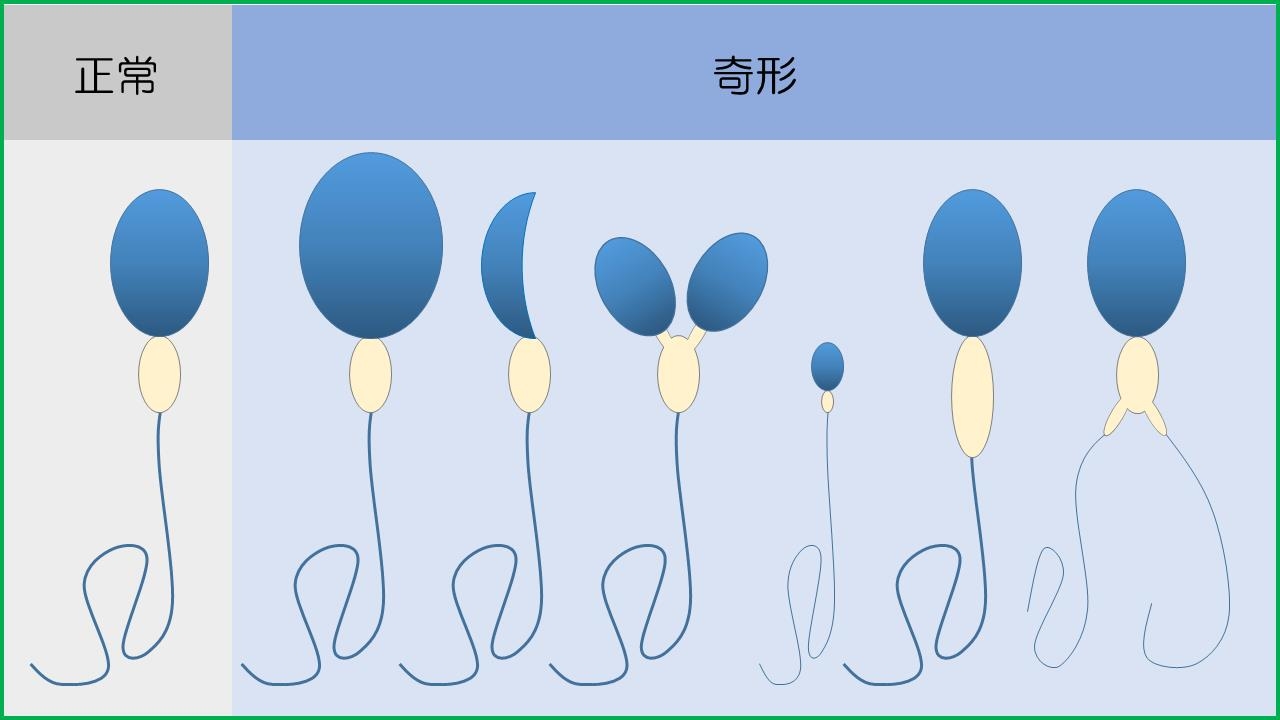 正常精子と奇形精子.jpg